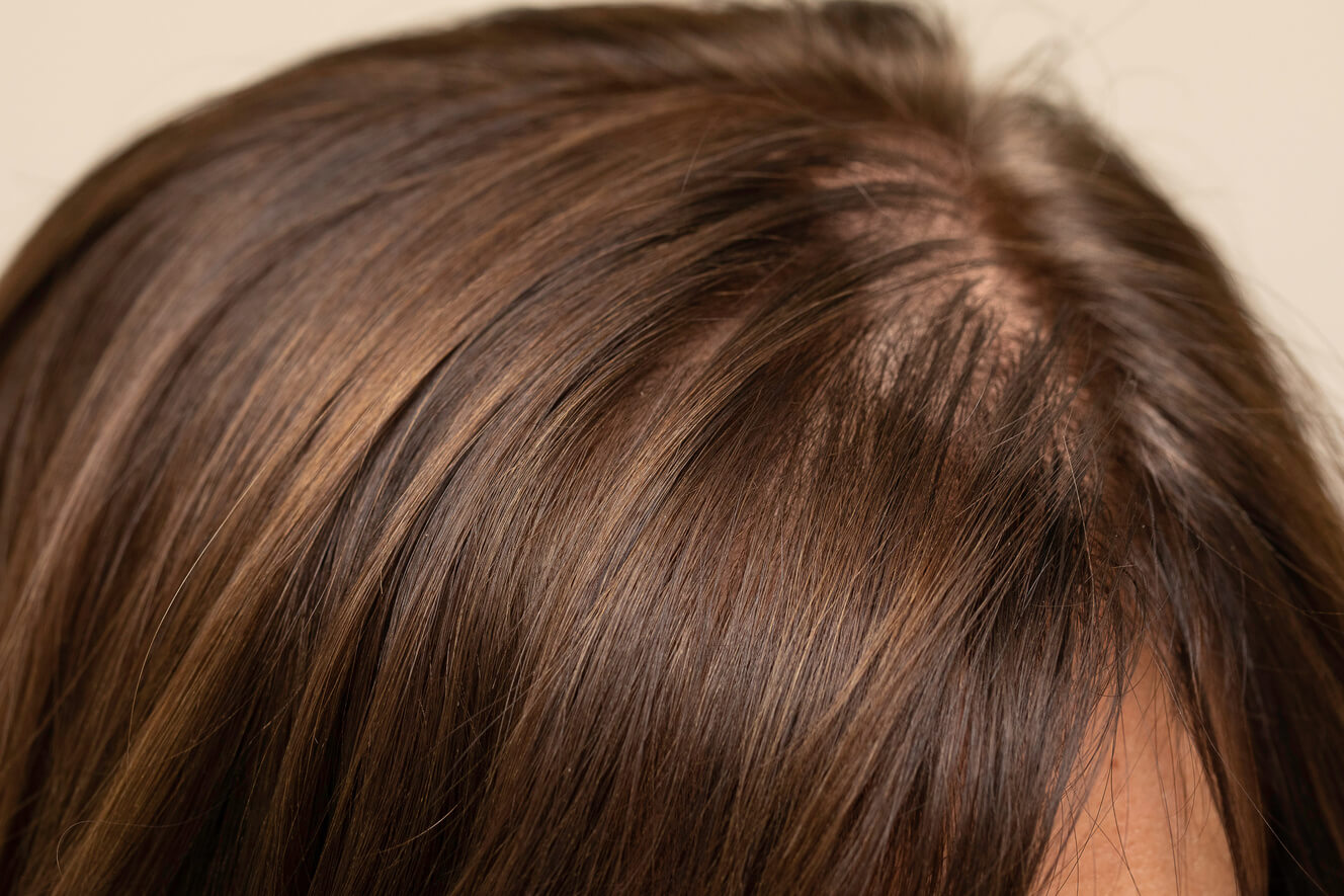 Quanti capelli si perdono al giorno